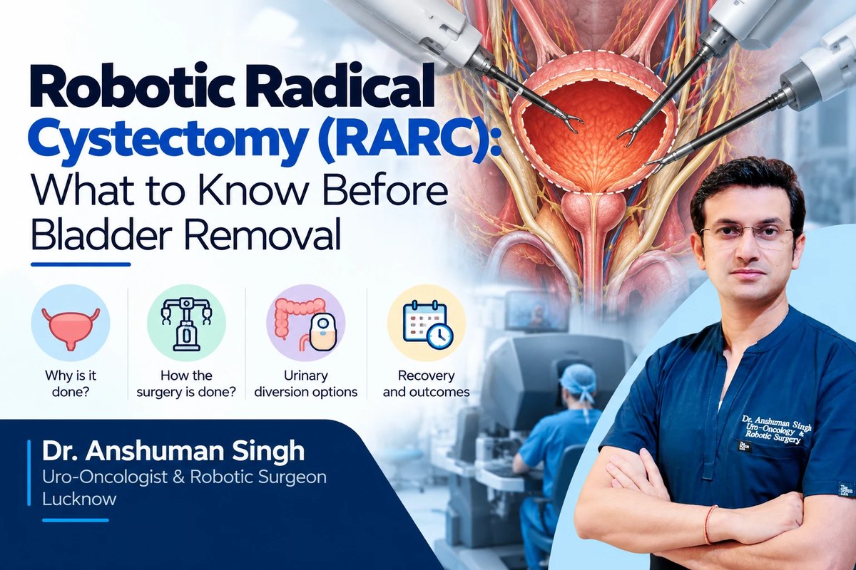 Illustration of robotic instruments removing the bladder within the pelvis, with a surgeon at the robotic console